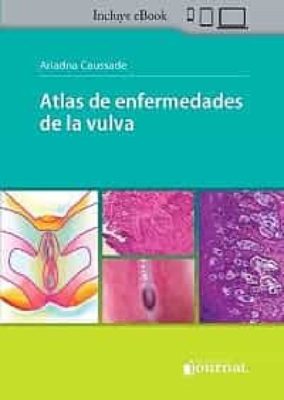 Atlas De Enfermedades De La Vulva